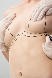 Dott  Dario Ioppolo Chirurgo Plastico e Medicina Esteticaa Milano, Como o Chiasso