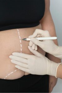 Dott  Dario Ioppolo Chirurgo Plastico e Medicina Esteticaa Milano, Como o Chiasso