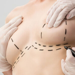 Dott  Dario Ioppolo Chirurgo Plastico e Medicina Esteticaa Milano, Como o Chiasso